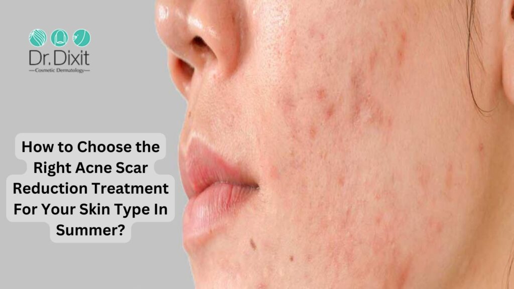 Skin Specialist In Bangalore, Acne Scar Reduction In Bangalore
